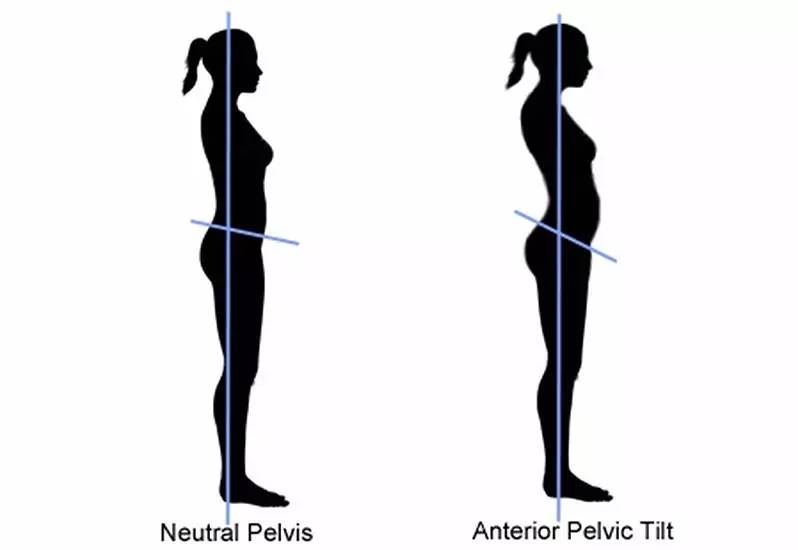 怎么改善腿型显腿长,不良体态显腿短怎么改善