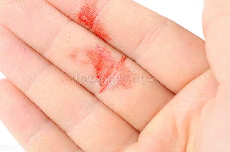 癌症早期发现的十大信号,如何发现早期癌症