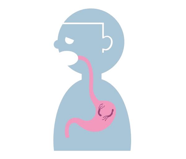 家里有幽门螺旋杆菌全家都会有吗,幽门螺旋杆菌全家都要一起治疗吗