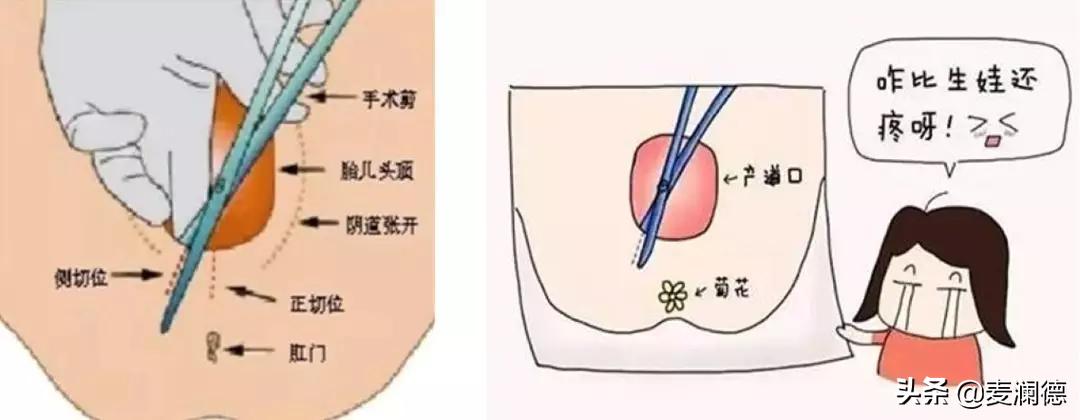 产前必看，十人顺产，减轻撕裂疼痛，方法现在就给你