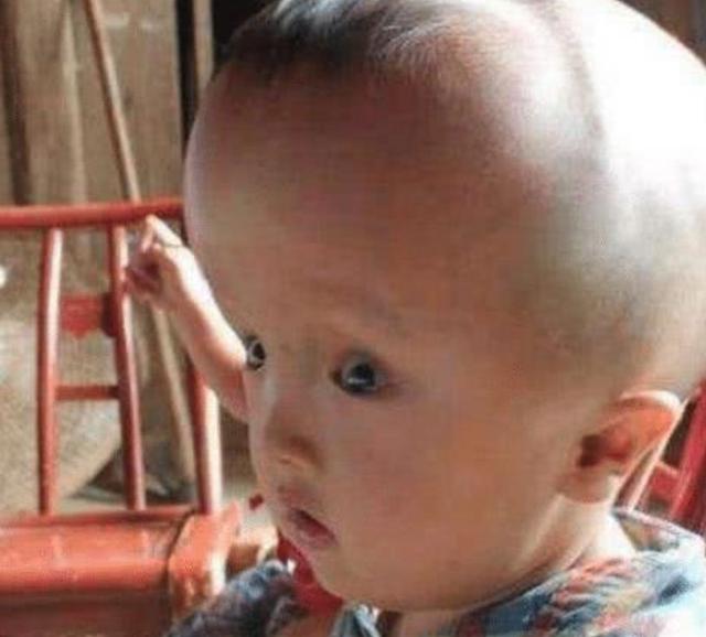 12年前的大头娃娃现在怎么样了,大头娃娃假奶粉事件发生哪一年