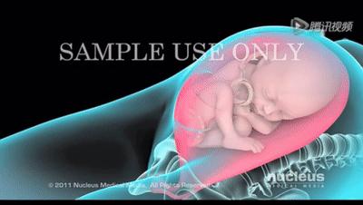 顺产怕侧切和撕裂怎么办,顺产侧切好过剖宫产吗