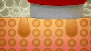 雅萌美容仪与宙斯美容仪哪个好,雅萌和宙斯美容仪对比