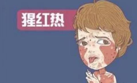 猩红热是皮肤病吗,猩红热样皮炎会传染吗
