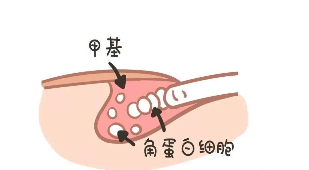 娃指甲上有白点是怎么回事,孩子指甲横纹有白点