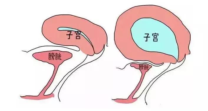 正常人憋尿多长时间有危险,防水需要注意事项