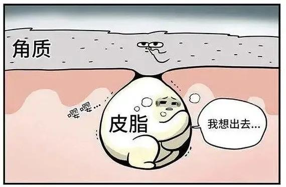 头皮屑多怎么根除最简单方法,如何彻底根治头皮屑的方法