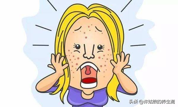 雄激素过高脸上长痘痘体毛多,满脸毛发旺盛怎么办