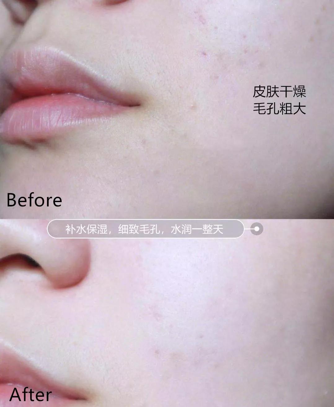 有黑头和没黑头有什么区别,没有长过黑头却长黑头怎么办