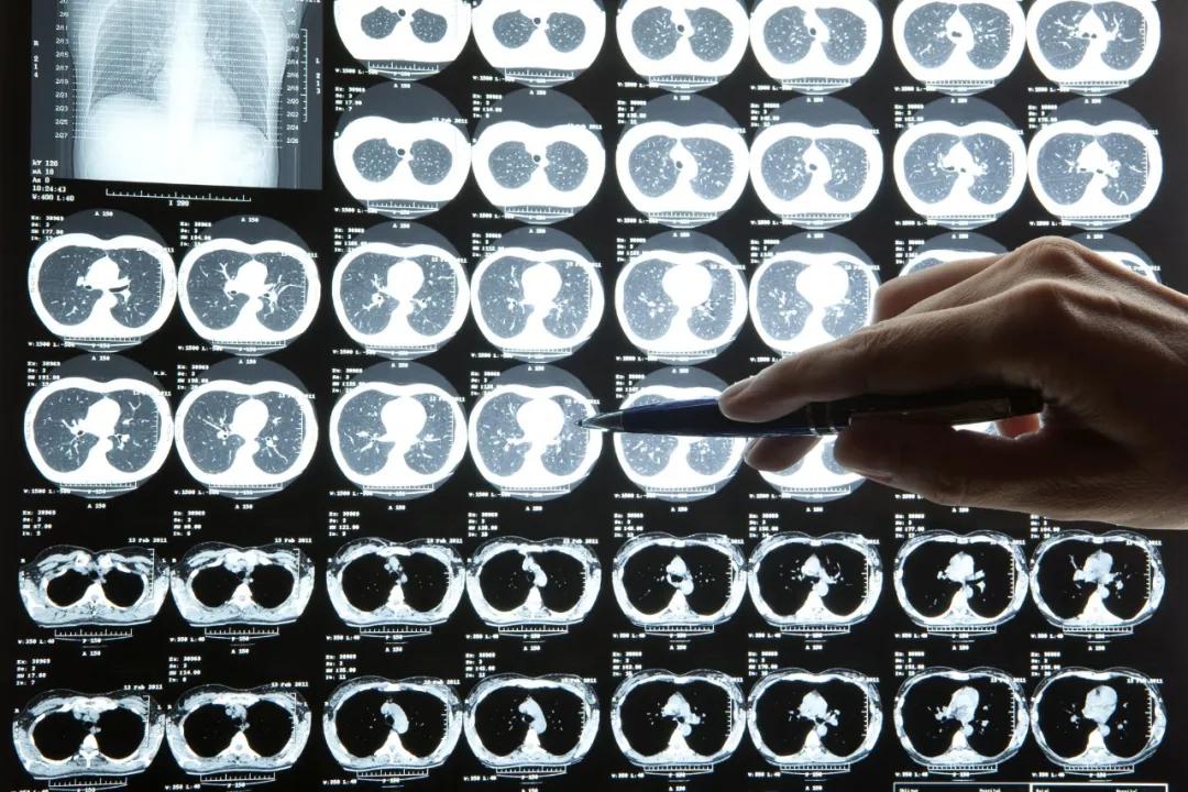 一个只烧钱不赚钱的行业，因为疫情迎来了春天