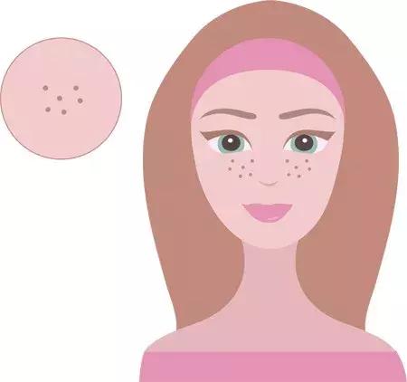 不同的斑不同的治疗方法,不同的斑不同的治疗方法文案