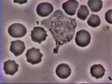 83天核事故救治纪录片,核灾83天死亡全记录