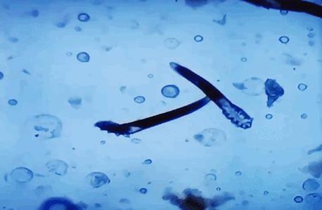 脸部除螨最有效的方法,眼睛除螨最有效的方法