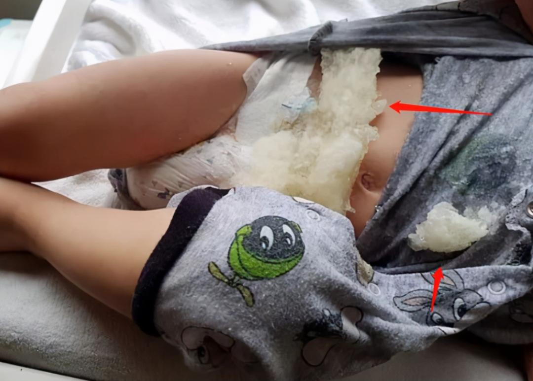 有没有给宝宝穿尿不湿崩溃的,宝宝穿尿不湿一天要换几片