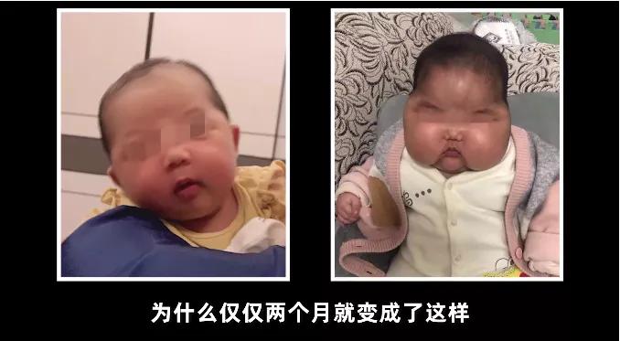 婴儿湿疹可以擦激素的药膏么,治疗宝宝湿疹不含激素的药膏