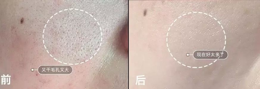 石头姐艾玛斯通拍摄,石头姐艾玛斯通新作品