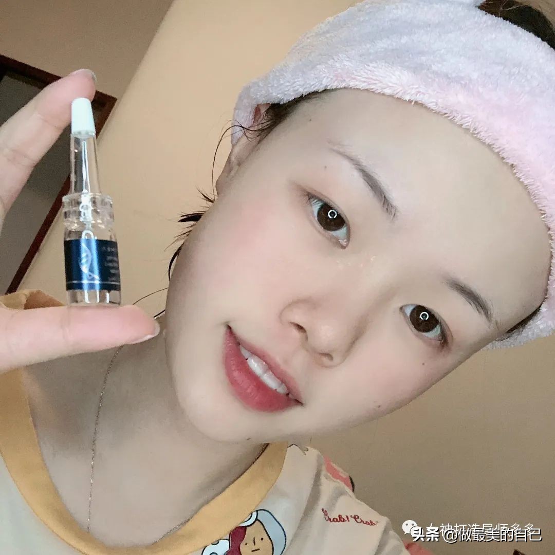 斑点暗黄肌最全的改善小技巧，都在这里