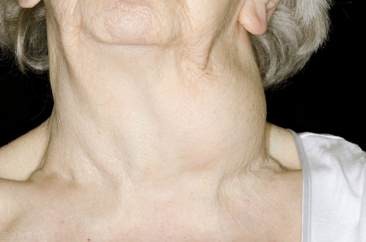 专家提醒:别让甲状腺疾病影响你的公务员体检