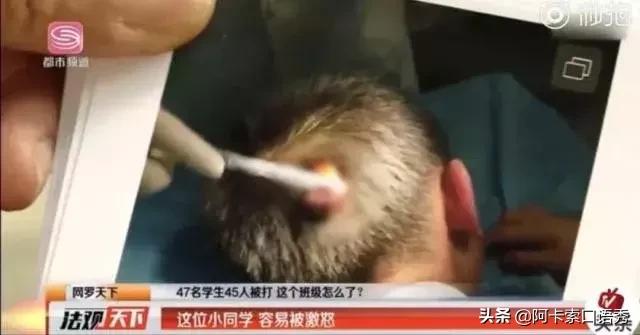 为什么被校园*力暴**中的孩子都不会尖叫？尖叫会有用吗？