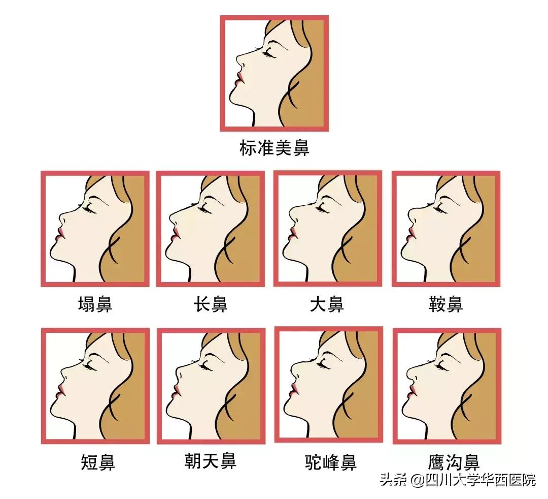 鼻子特别大怎么修,鼻子大如何修鼻子