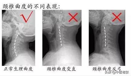 tvb老戏骨突发心脏病去世 (tvb老戏骨患癌症欠巨额债务)