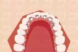 快看！这家店拯救了90%汕头人的牙齿烦恼