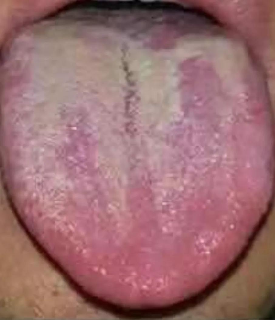 腰酸背痛怕冷尿多是不是肾阳虚,尿频腰酸后背发热是肾阴虚表现吗