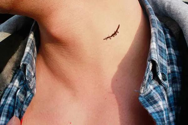 阿莫西林并非万能消炎药!不了解禁忌就乱用,容易伤身体