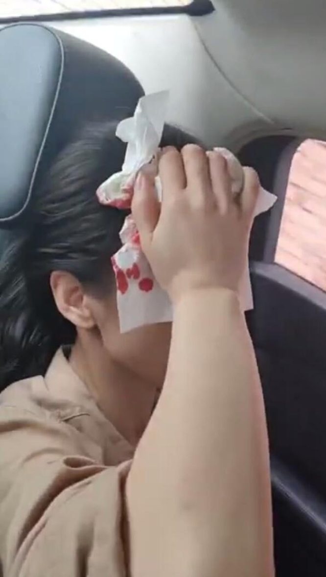 黄圣依带伤录制综艺节目,黄圣依受伤视频曝光