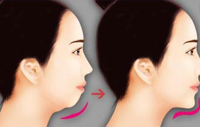 下巴不翘可能不具备这4个标准用这种方法一步解决！