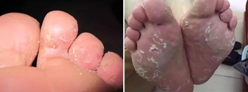 穿几十块的鞋会脚臭吗,穿几十块钱的鞋子臭脚吗