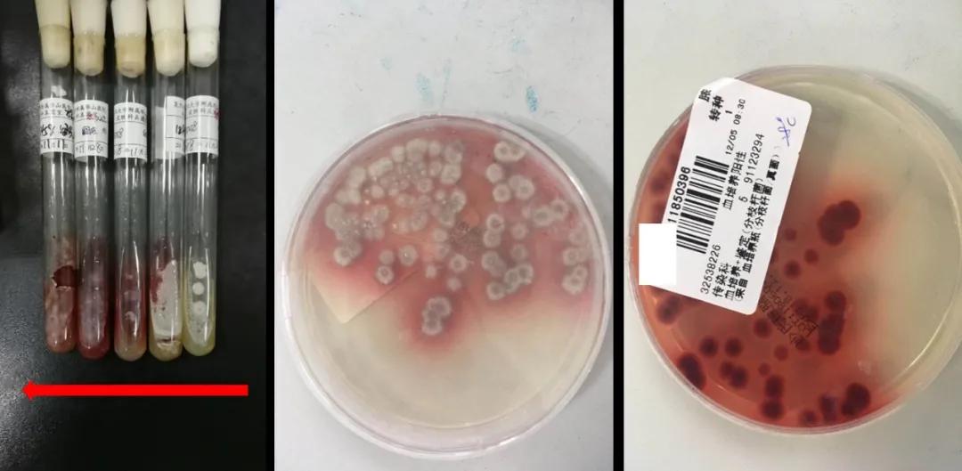 从感冒到癌症,从感冒到癌症只需九步