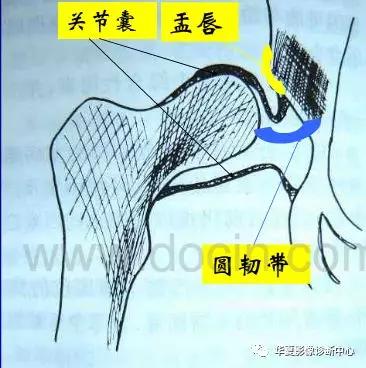 先天性髋关节脱位,先天性髋关节脱位属不属于残疾人