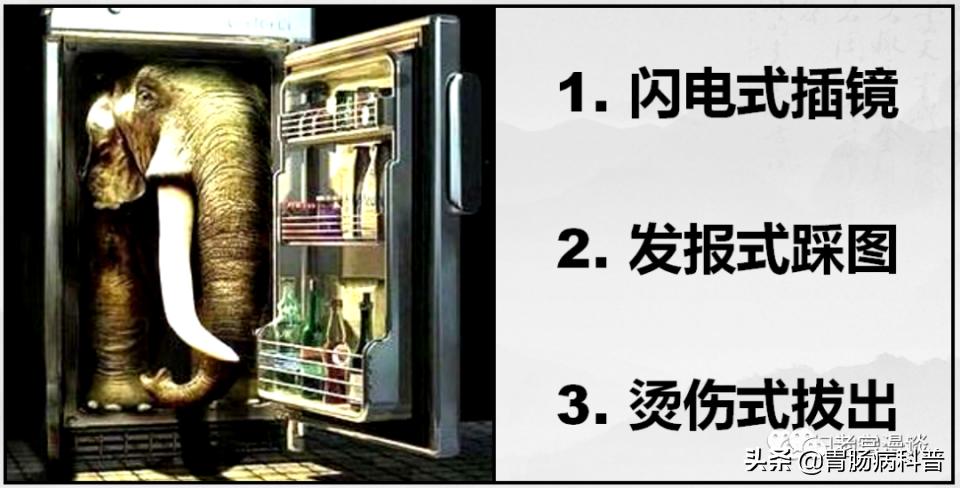 胃镜怎么做全过程,胃镜怎么做的全过程