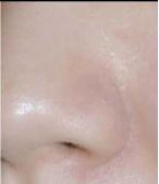 打败毛孔！下一个反孔精英就是你！