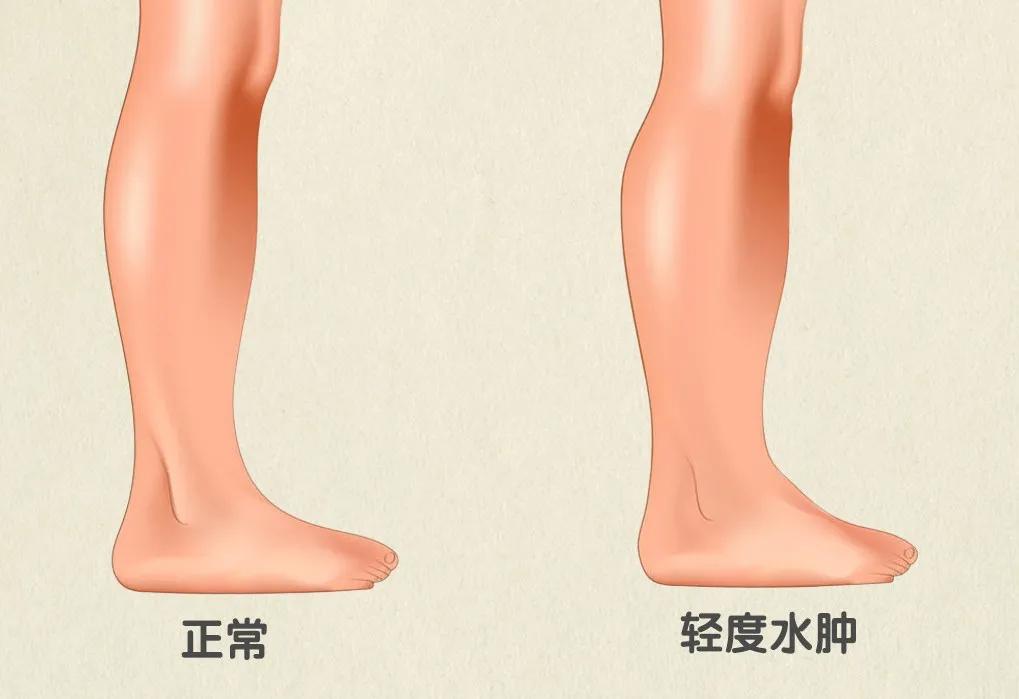 男生腿比女生腿直的医学原因,男生腿普遍比女生细科普