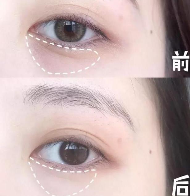 眼霜排名十大公认好用的眼霜平价,眼霜哪款才是真正有效好用