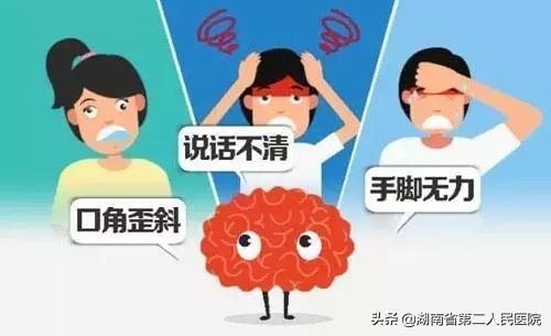 一觉睡醒头晕目眩，不是眩晕症竟是脑卒中