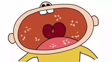 新手妈妈别惊慌,叫你搞定鹅口疮