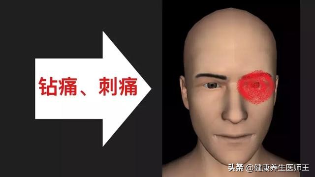 人体健康之丛集性头痛