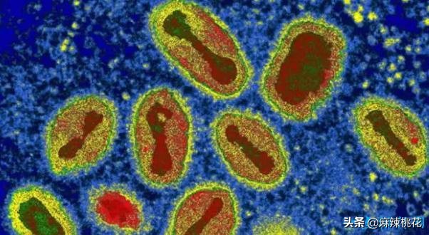 最危险的10种致命病毒,世界最难治病毒