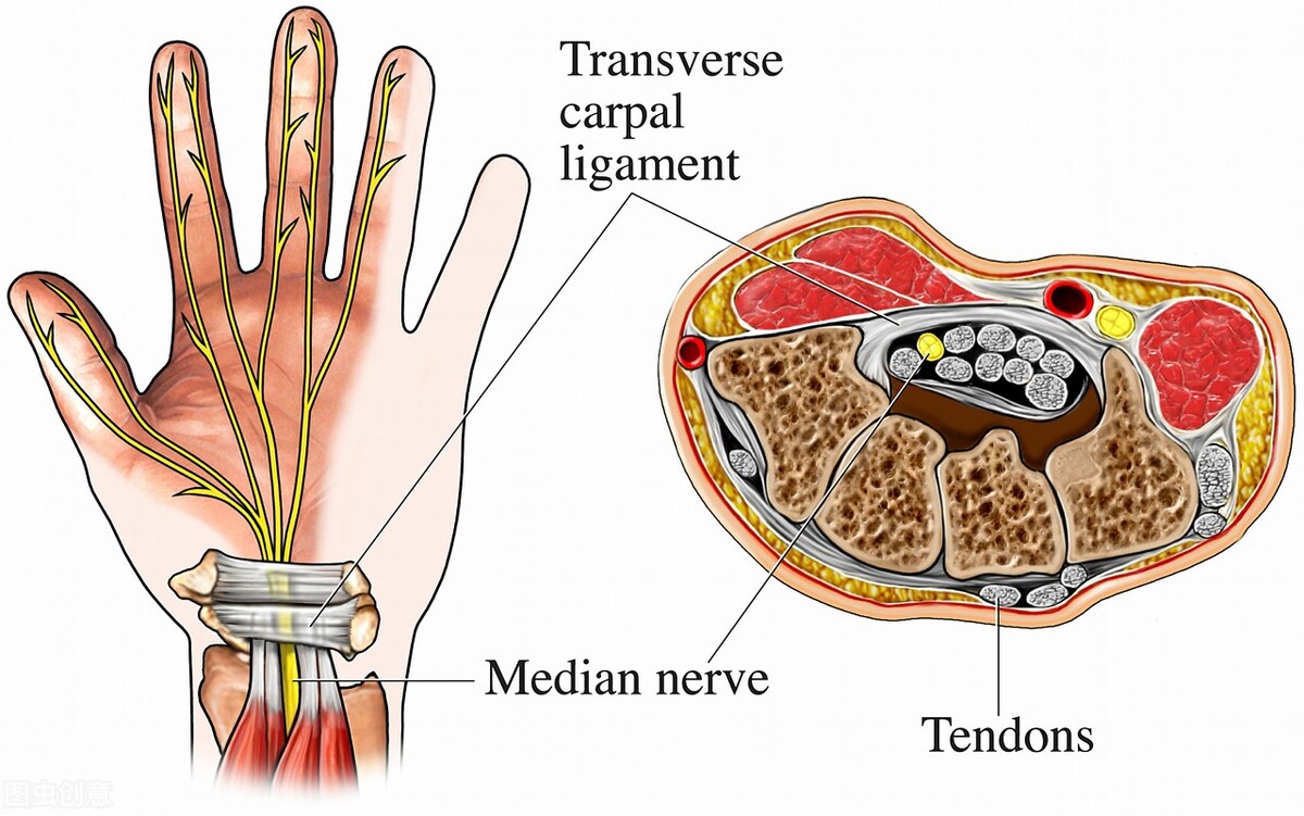 腱鞘囊肿开刀会碰到筋吗,腱鞘囊肿不想去医院自己怎样康复