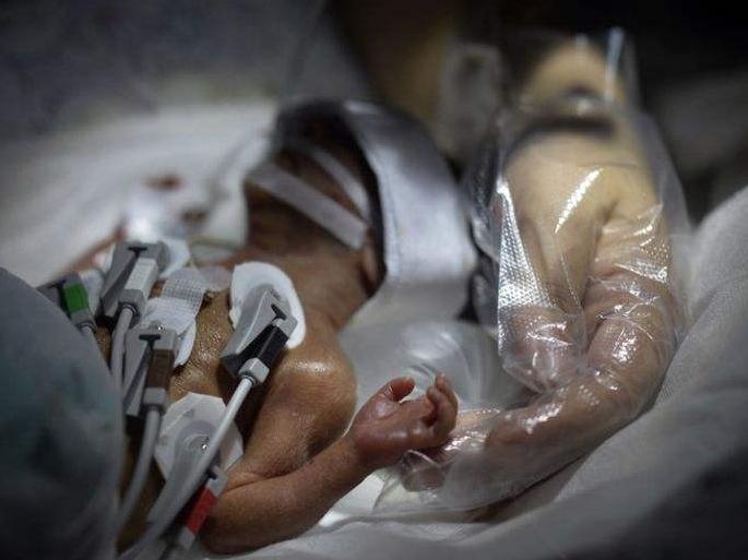 医院要求早产宝宝袋鼠式护理,早产宝宝袋鼠抱妈妈要穿内衣吗