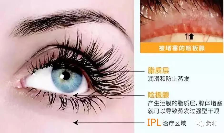 眼睛发干发涩发胀什么原因,眼睛发涩疲倦头发胀是怎么回事