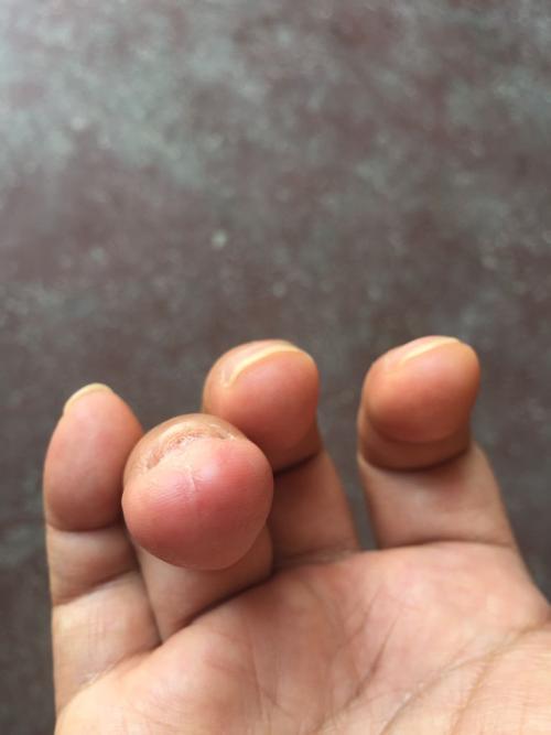 工伤你了解多少,关于工伤的十大问题