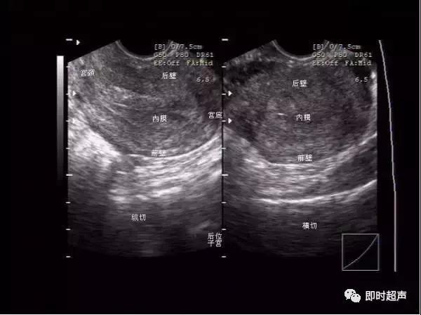 盆底超声可检查什么疾病,哪些疾病需要做妇科检查