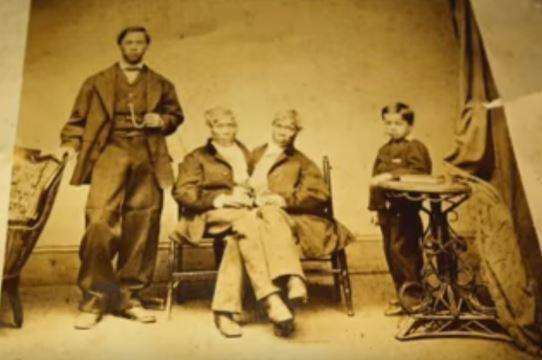 中国连体双胞胎兄弟,连体兄弟中国