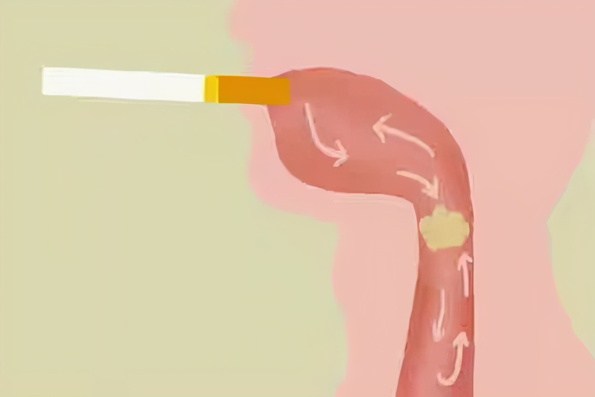 吐白痰和黑痰有什么区别,咳出黄痰黑痰白痰分别说明了啥