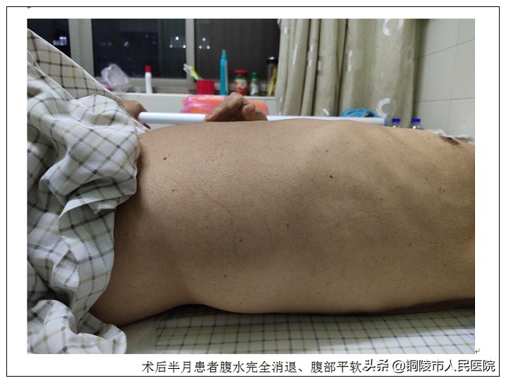 市人民医院介入科,人民医院导管室