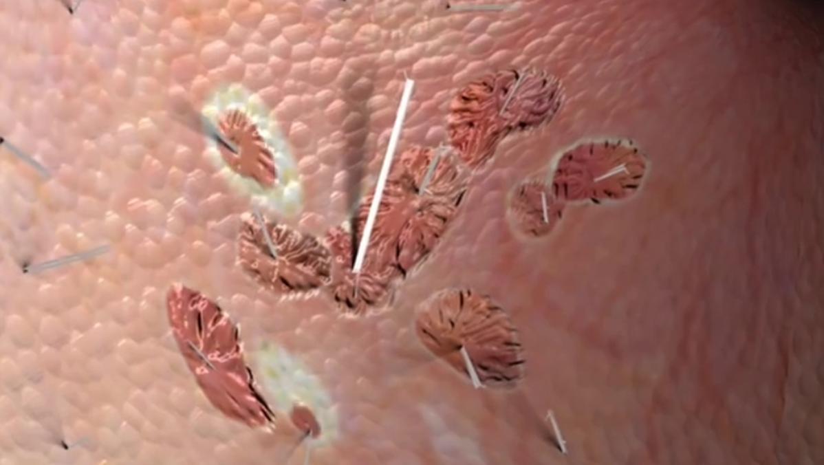 现在农村的石棉瓦有危害吗,石棉瓦盖房子有危害吗